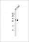 GDF15  Antibody